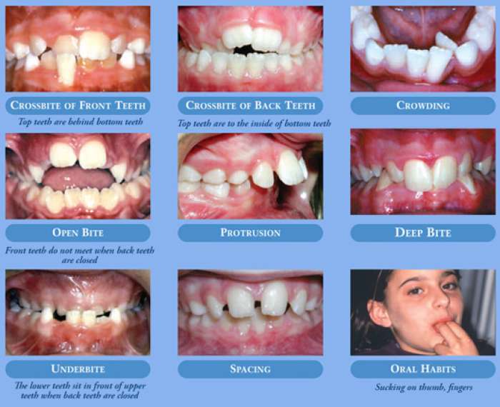 orthodontics-winning-smiles
